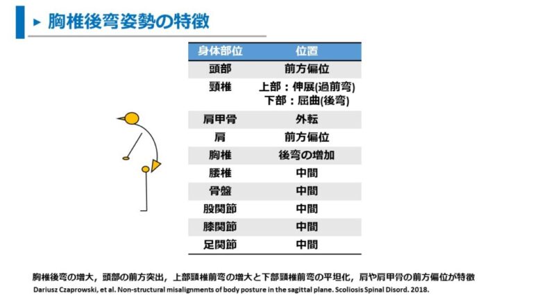 円背原因理学療法 | 円背 治し方 _ 高齢者の姿勢について – NTWD